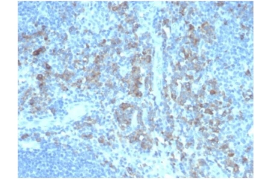 Immunohistochemistry - Anti-CD5L Antibody [CD5L/4420] (A277843) - Antibodies.com
