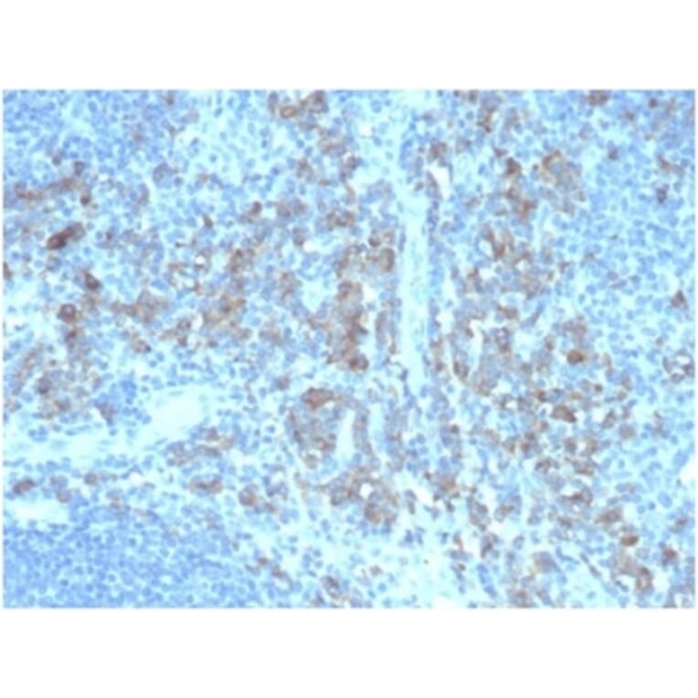Immunohistochemistry - Anti-CD5L Antibody [CD5L/4420] (A277843) - Antibodies.com