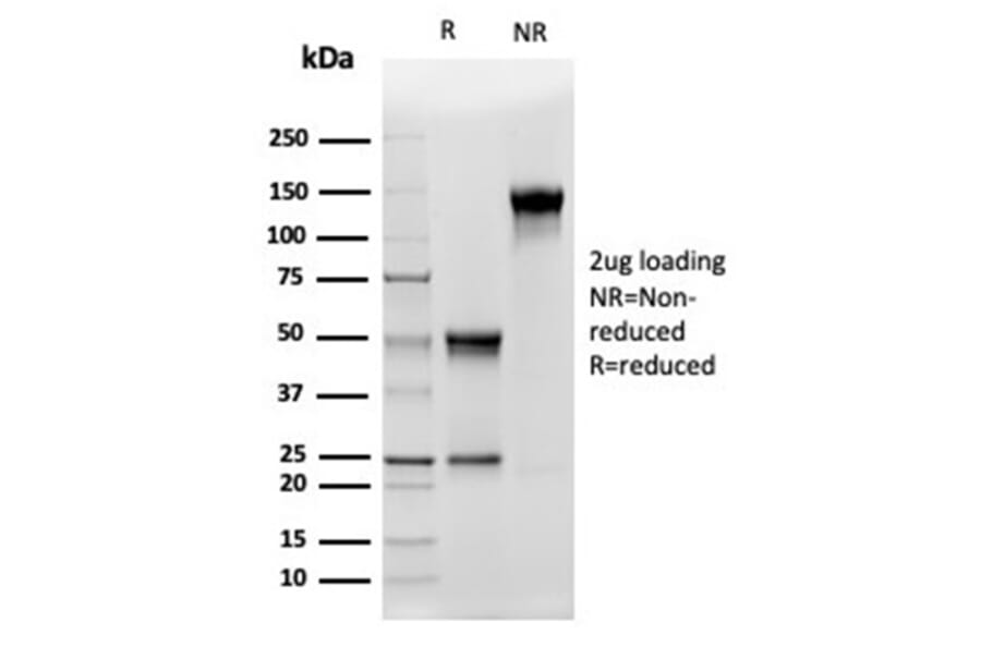 SDS-PAGE - Anti-CD5L Antibody [CD5L/4420] (A277843) - Antibodies.com