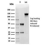 SDS-PAGE - Anti-CD5L Antibody [CD5L/4420] (A277843) - Antibodies.com