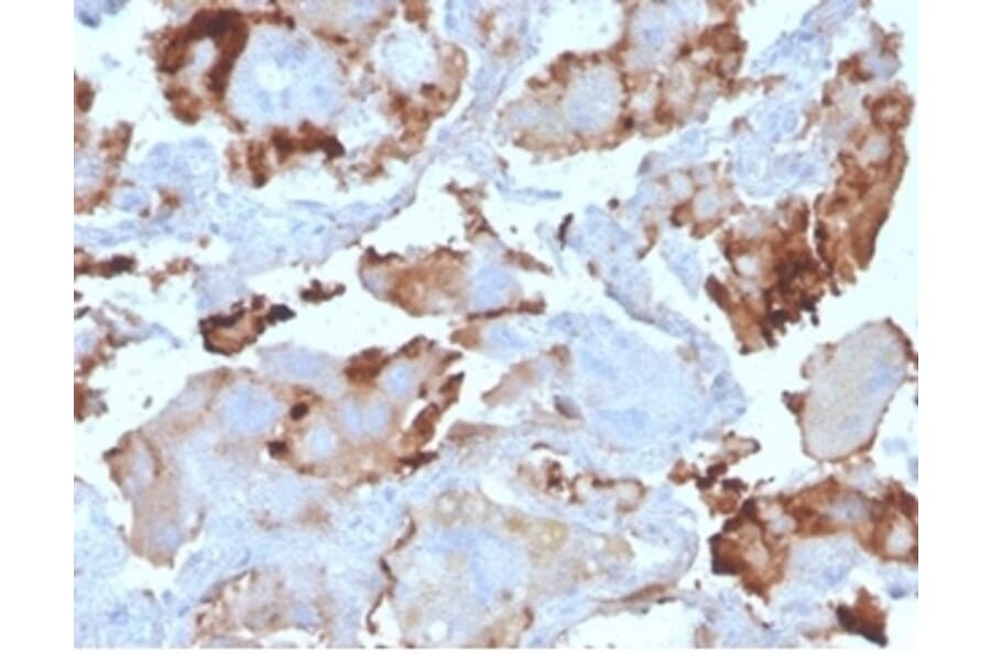 Immunohistochemistry - Anti-L-PLUNC Antibody [LPLUNC1/3206] (A277844) - Antibodies.com