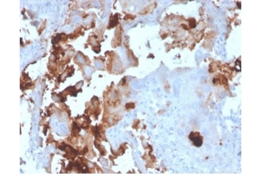 Immunohistochemistry - Anti-L-PLUNC Antibody [LPLUNC1/3206] (A277844) - Antibodies.com