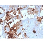 Immunohistochemistry - Anti-L-PLUNC Antibody [LPLUNC1/3206] (A277844) - Antibodies.com