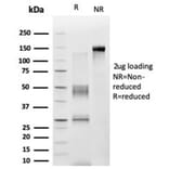 SDS-PAGE - Anti-ZNF276 Antibody [PCRP-ZNF276-1A5] (A277845) - Antibodies.com