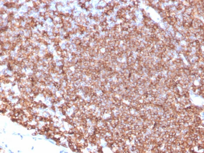 Immunohistochemical analysis of formalin-fixed, paraffin-embedded human tonsil tissue using Anti-CD20 Antibody [MS4A1/4655].