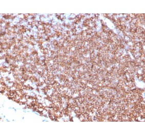 Immunohistochemistry - Anti-CD20 Antibody [MS4A1/4655] (A277846) - Antibodies.com