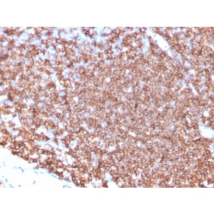 Immunohistochemistry - Anti-CD20 Antibody [MS4A1/4655] (A277846) - Antibodies.com