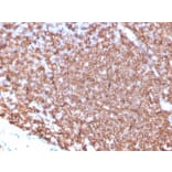 Immunohistochemistry - Anti-CD20 Antibody [MS4A1/4655] (A277846) - Antibodies.com