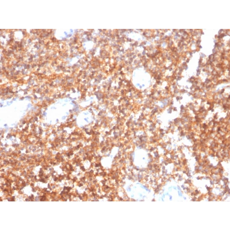 Immunohistochemistry - Anti-CD20 Antibody [MS4A1/4655] (A277846) - Antibodies.com