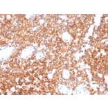 Immunohistochemistry - Anti-CD20 Antibody [MS4A1/4655] (A277846) - Antibodies.com