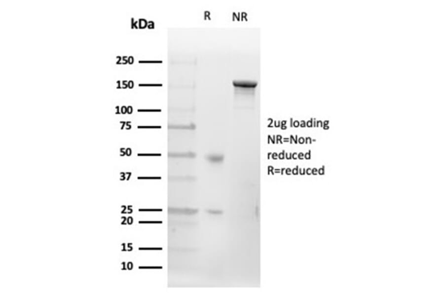 SDS-PAGE - Anti-CD20 Antibody [MS4A1/4655] (A277846) - Antibodies.com