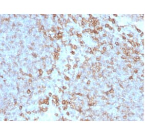 Immunohistochemistry - Anti-CD27 Antibody [LPFS2/4176] (A277847) - Antibodies.com