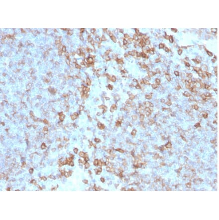 Immunohistochemistry - Anti-CD27 Antibody [LPFS2/4176] (A277847) - Antibodies.com