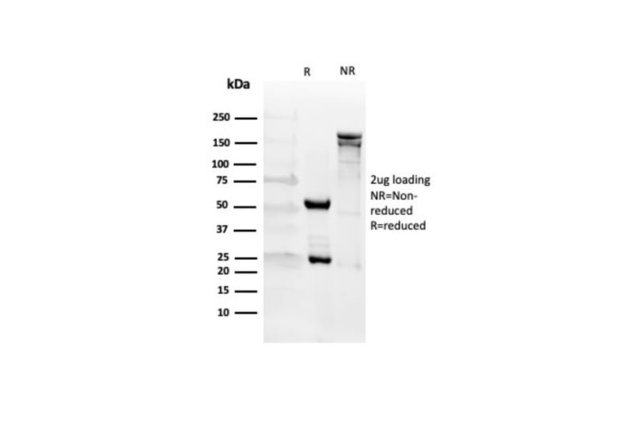 SDS-PAGE - Anti-CD27 Antibody [LPFS2/4176] (A277847) - Antibodies.com
