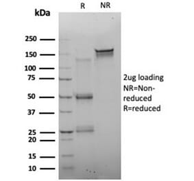 SDS-PAGE - Anti-FOXQ1 Antibody [PCRP-FOXQ1-2D2] (A277850) - Antibodies.com