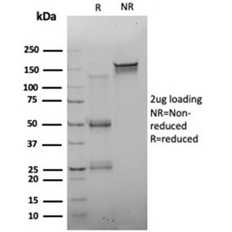 SDS-PAGE - Anti-FOXQ1 Antibody [PCRP-FOXQ1-2D2] (A277850) - Antibodies.com