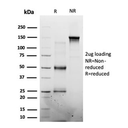 SDS-PAGE - Anti-MED7 Antibody [PCRP-MED7-1B8] (A277851) - Antibodies.com