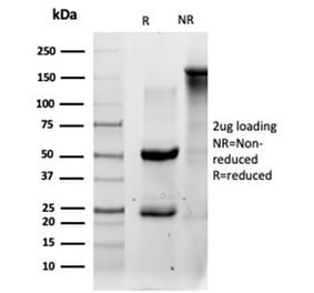 SDS-PAGE - Anti-QKI Antibody [PCRP-QKI-2F10] (A277852) - Antibodies.com