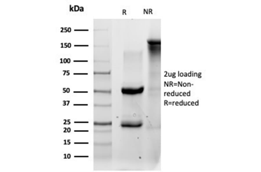 SDS-PAGE - Anti-QKI Antibody [PCRP-QKI-2F10] (A277852) - Antibodies.com