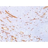 Immunohistochemistry - Anti-CD34 Antibody [CD34/4939] (A277853) - Antibodies.com