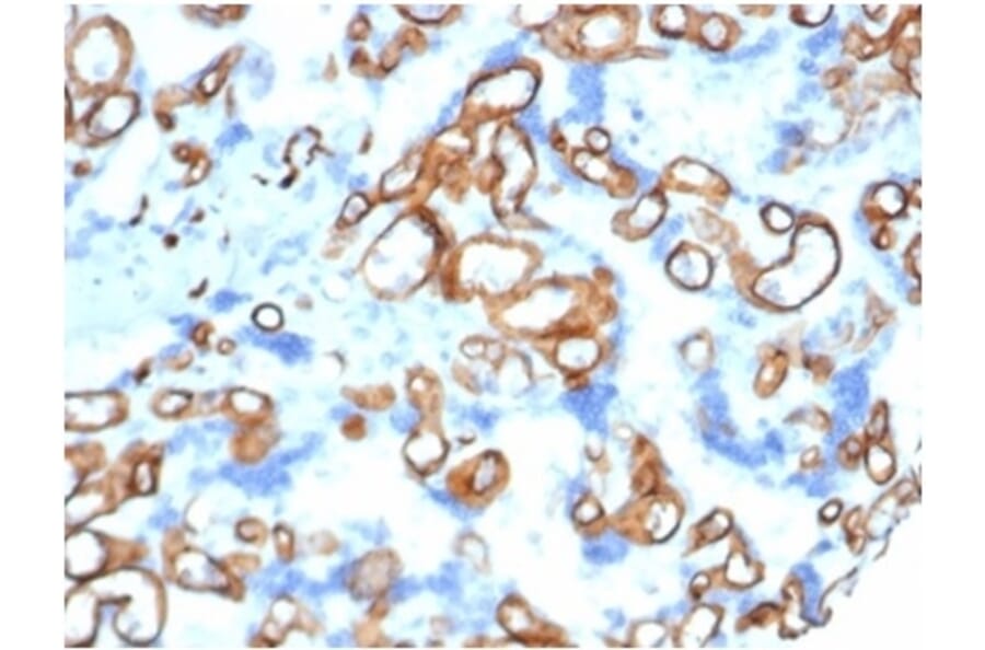 Immunohistochemistry - Anti-CD34 Antibody [CD34/4939] (A277853) - Antibodies.com