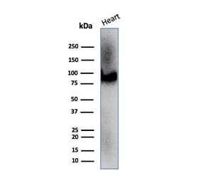 Western Blot - Anti-CD36 Antibody [CD36/7217] (A277854) - Antibodies.com