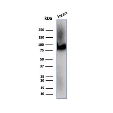 Western Blot - Anti-CD36 Antibody [CD36/7217] (A277854) - Antibodies.com