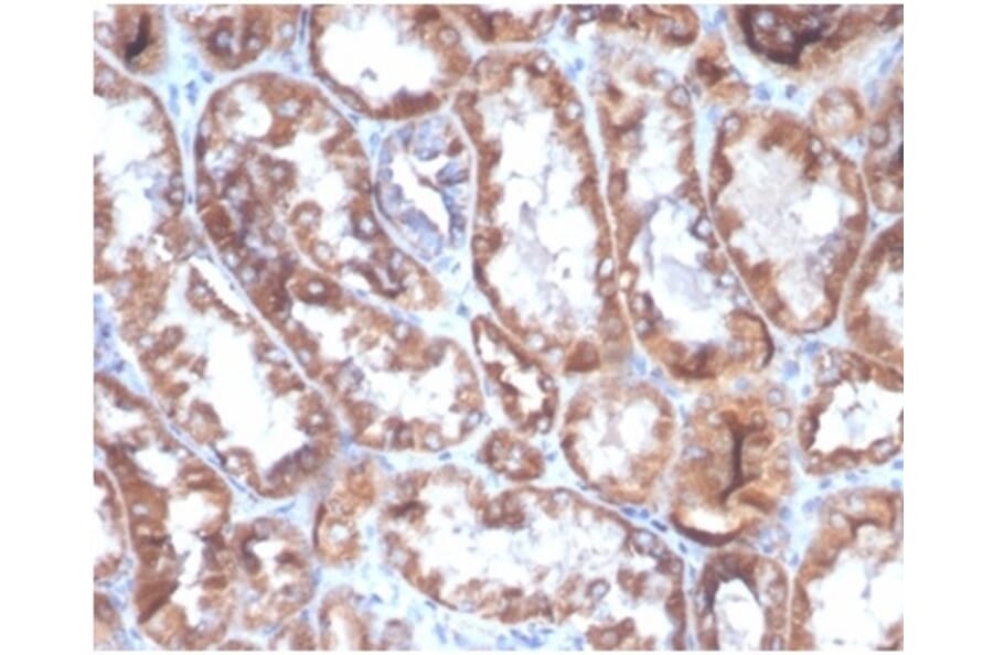 Immunohistochemistry - Anti-CD40L Antibody [CD40LG/4675] (A277856) - Antibodies.com