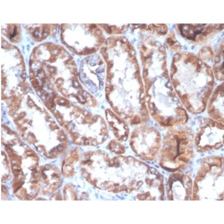Immunohistochemistry - Anti-CD40L Antibody [CD40LG/4675] (A277856) - Antibodies.com