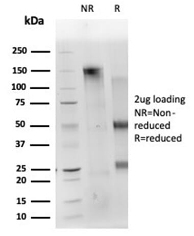 SDS-PAGE analysis of Anti-CD40L Antibody [CD40LG/4675] under non-reduced and reduced conditions; showing intact IgG and intact heavy and light chains, respectively. SDS-PAGE analysis confirms the integrity and purity of the antibody.