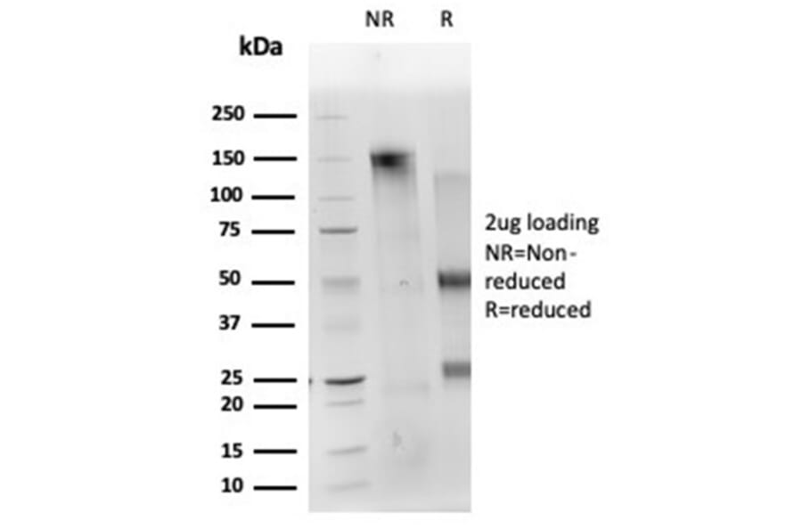 SDS-PAGE - Anti-CD40L Antibody [CD40LG/4675] (A277856) - Antibodies.com