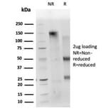 SDS-PAGE - Anti-CD40L Antibody [CD40LG/4675] (A277856) - Antibodies.com
