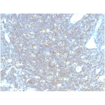 Immunohistochemistry - Anti-CD48 Antibody [CD48/4783] (A277857) - Antibodies.com