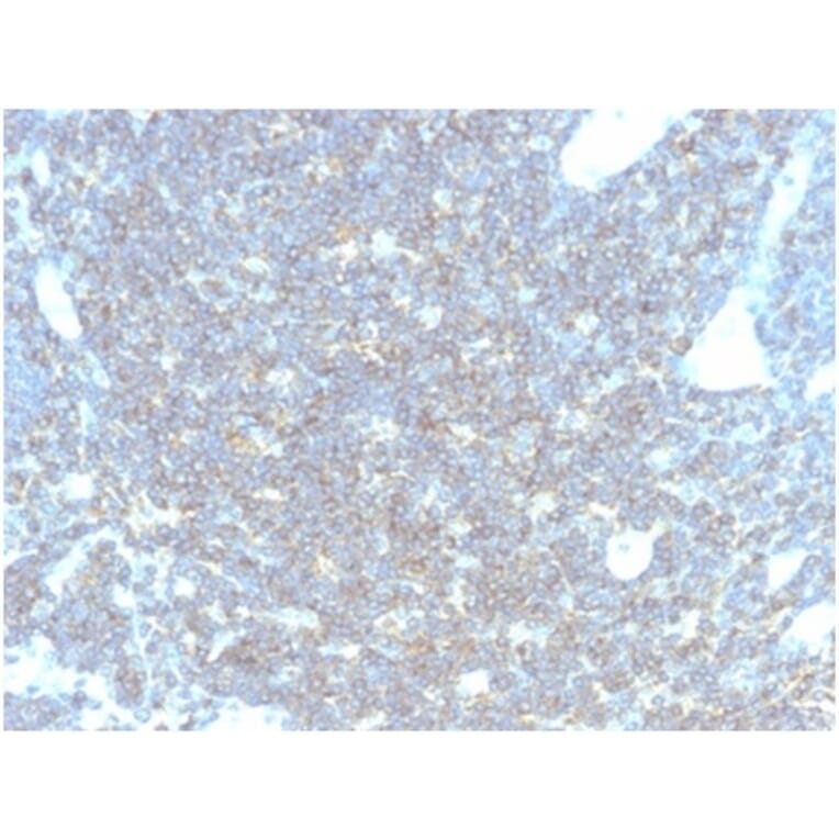 Immunohistochemistry - Anti-CD48 Antibody [CD48/4783] (A277857) - Antibodies.com