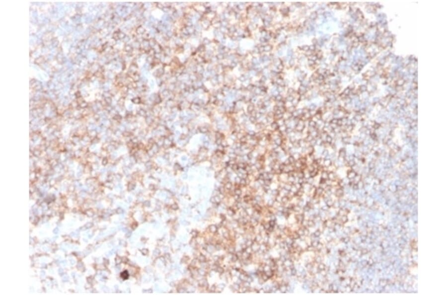 Immunohistochemistry - Anti-CD48 Antibody [CD48/4783] (A277857) - Antibodies.com