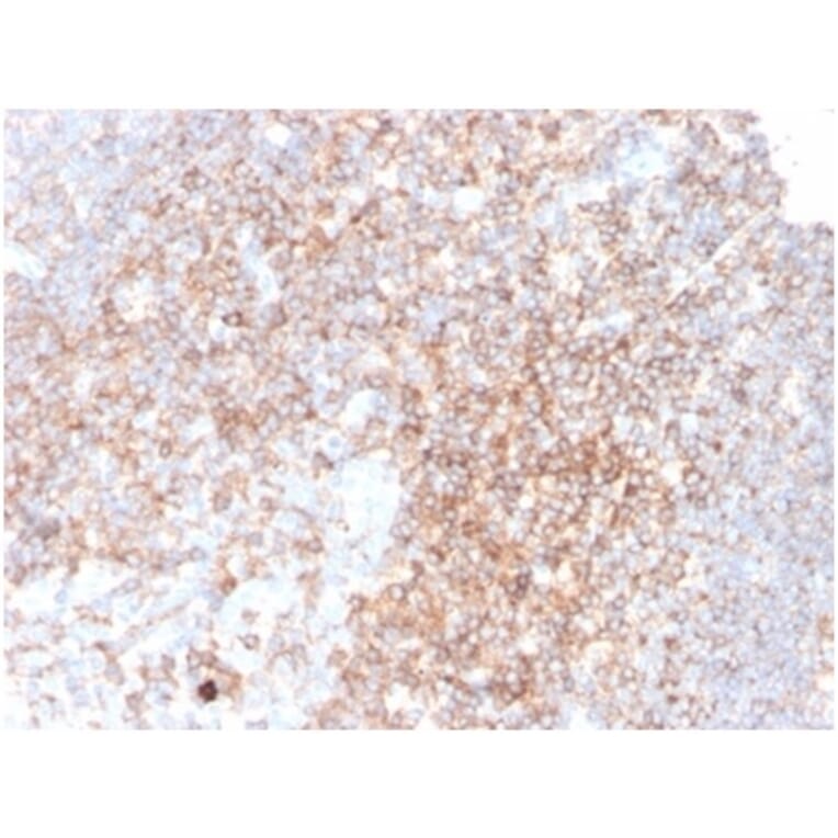 Immunohistochemistry - Anti-CD48 Antibody [CD48/4783] (A277857) - Antibodies.com