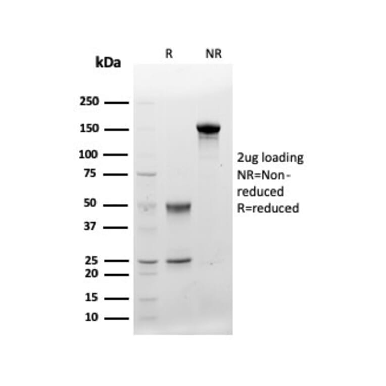 Protein Array - Anti-CD48 Antibody [CD48/4783] (A277857) - Antibodies.com
