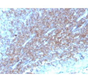 Immunohistochemistry - Anti-CD48 Antibody [CD48/4784] (A277858) - Antibodies.com