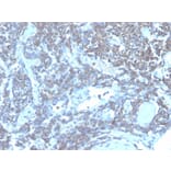 Immunohistochemistry - Anti-CD48 Antibody [CD48/4784] (A277858) - Antibodies.com