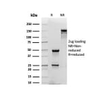 SDS-PAGE - Anti-CD48 Antibody [CD48/4784] (A277858) - Antibodies.com