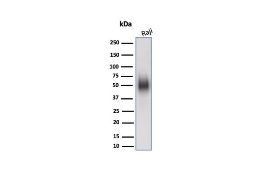 Western Blot - Anti-CD48 Antibody [CD48/4784] (A277858) - Antibodies.com