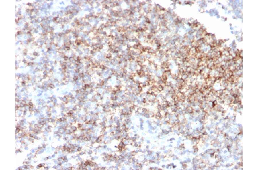 Immunohistochemistry - Anti-CD48 Antibody [CD48/4785] (A277859) - Antibodies.com