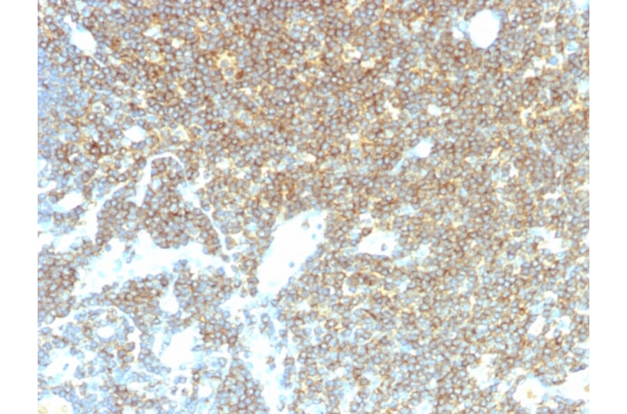 Immunohistochemistry - Anti-CD48 Antibody [CD48/4785] (A277859) - Antibodies.com