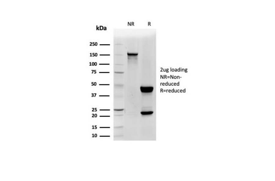 SDS-PAGE - Anti-CD48 Antibody [CD48/4785] (A277859) - Antibodies.com