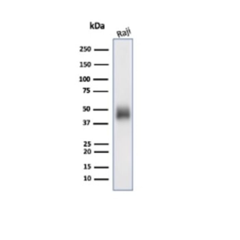 Western Blot - Anti-CD48 Antibody [CD48/4785] (A277859) - Antibodies.com