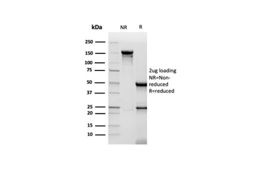 SDS-PAGE - Anti-CD48 Antibody [CD48/4786] (A277860) - Antibodies.com