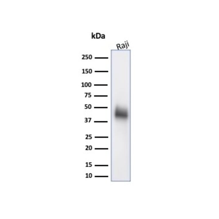Western Blot - Anti-CD48 Antibody [CD48/4786] (A277860) - Antibodies.com