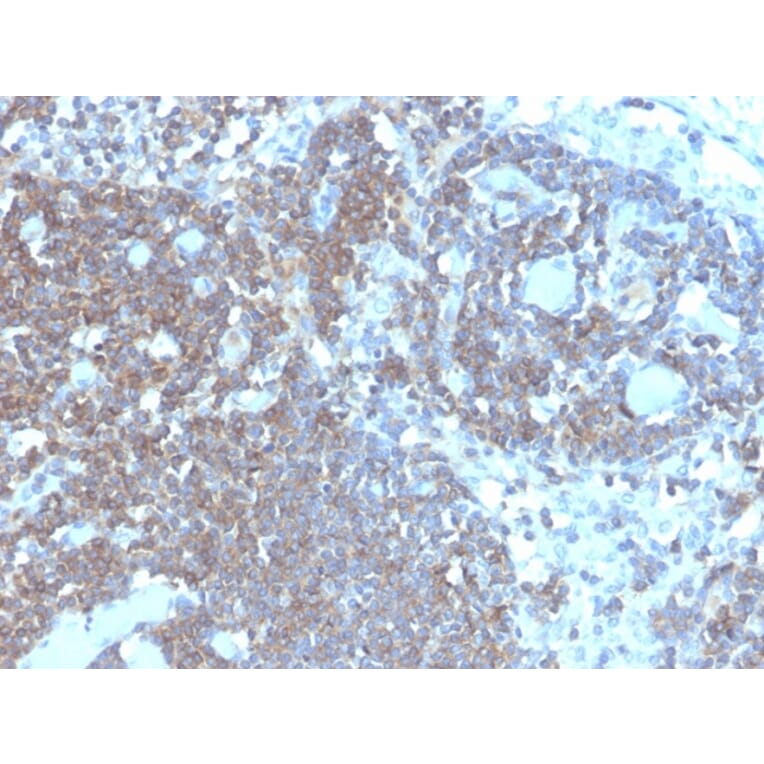 Immunohistochemistry - Anti-CD48 Antibody [CD48/4787] (A277861) - Antibodies.com