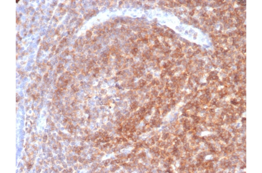 Immunohistochemistry - Anti-CD48 Antibody [CD48/4787] (A277861) - Antibodies.com