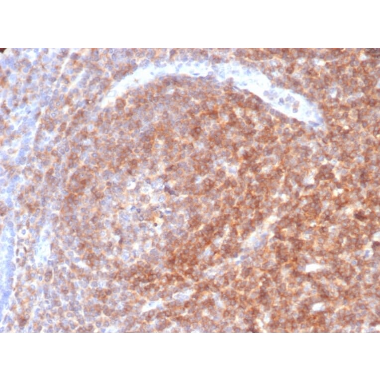 Immunohistochemistry - Anti-CD48 Antibody [CD48/4787] (A277861) - Antibodies.com